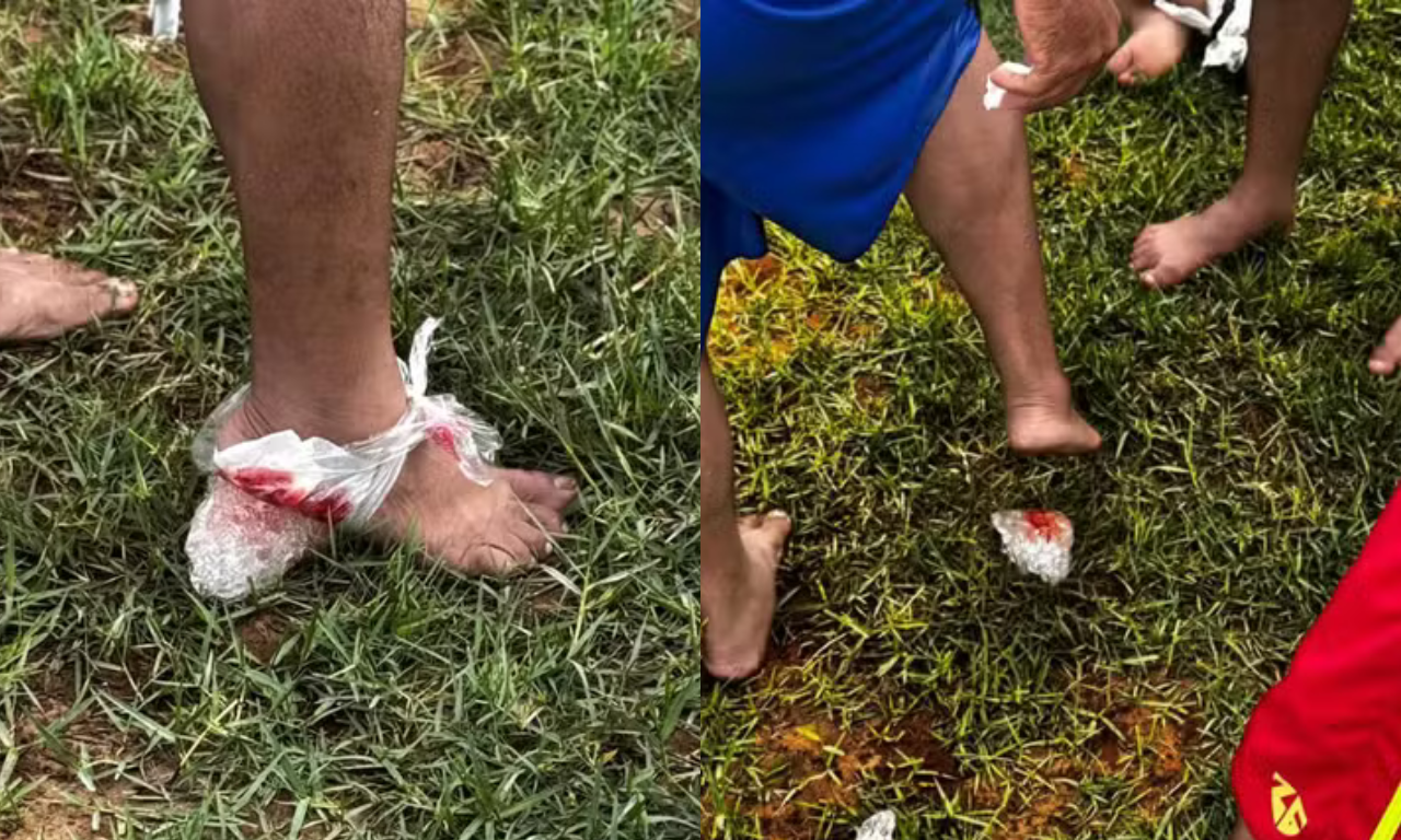 Ataque de piranhas deixa pelo menos dez feridos na Bahia.Foto: Reprodu&ccedil;&atilde;o