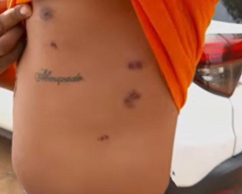 Homem relatou ter sido agredido por Guardas Municipais e da Transalvador/ Foto: Tv Aratu