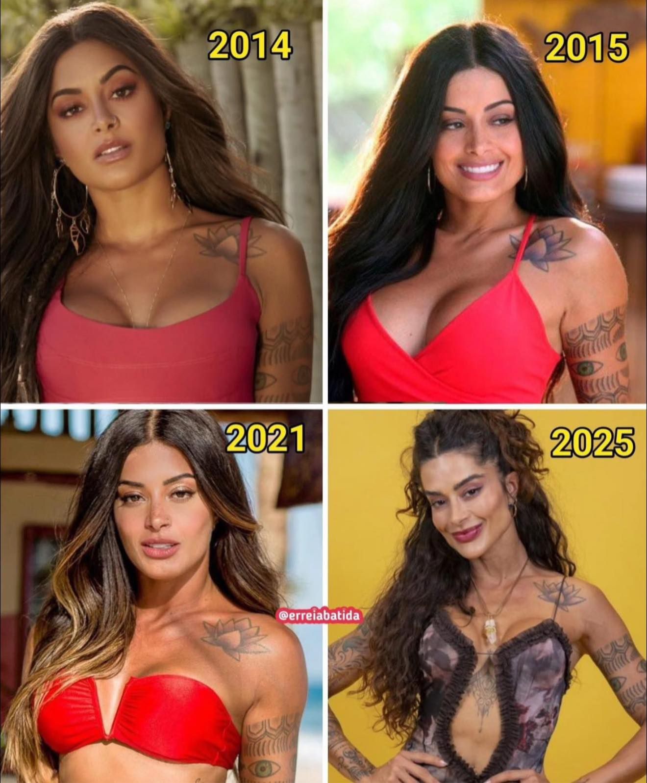 Aline contou que iniciou as interven&ccedil;&otilde;es est&eacute;ticas aos 25 anos, come&ccedil;ando pelo uso de botox. | Foto: Redes Sociais