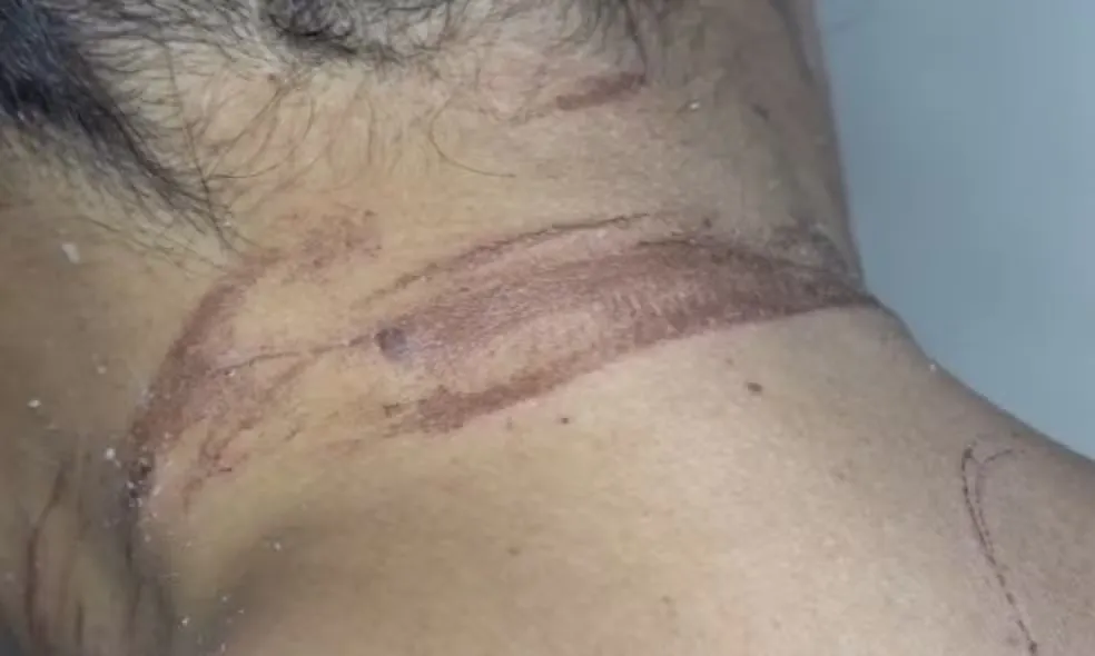 Mulher é enterrada viva pelo ex-namorado e sobrevive em Itabuna