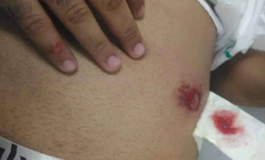 Urgente! PM é baleado durante confronto no bairro da Engomadeira