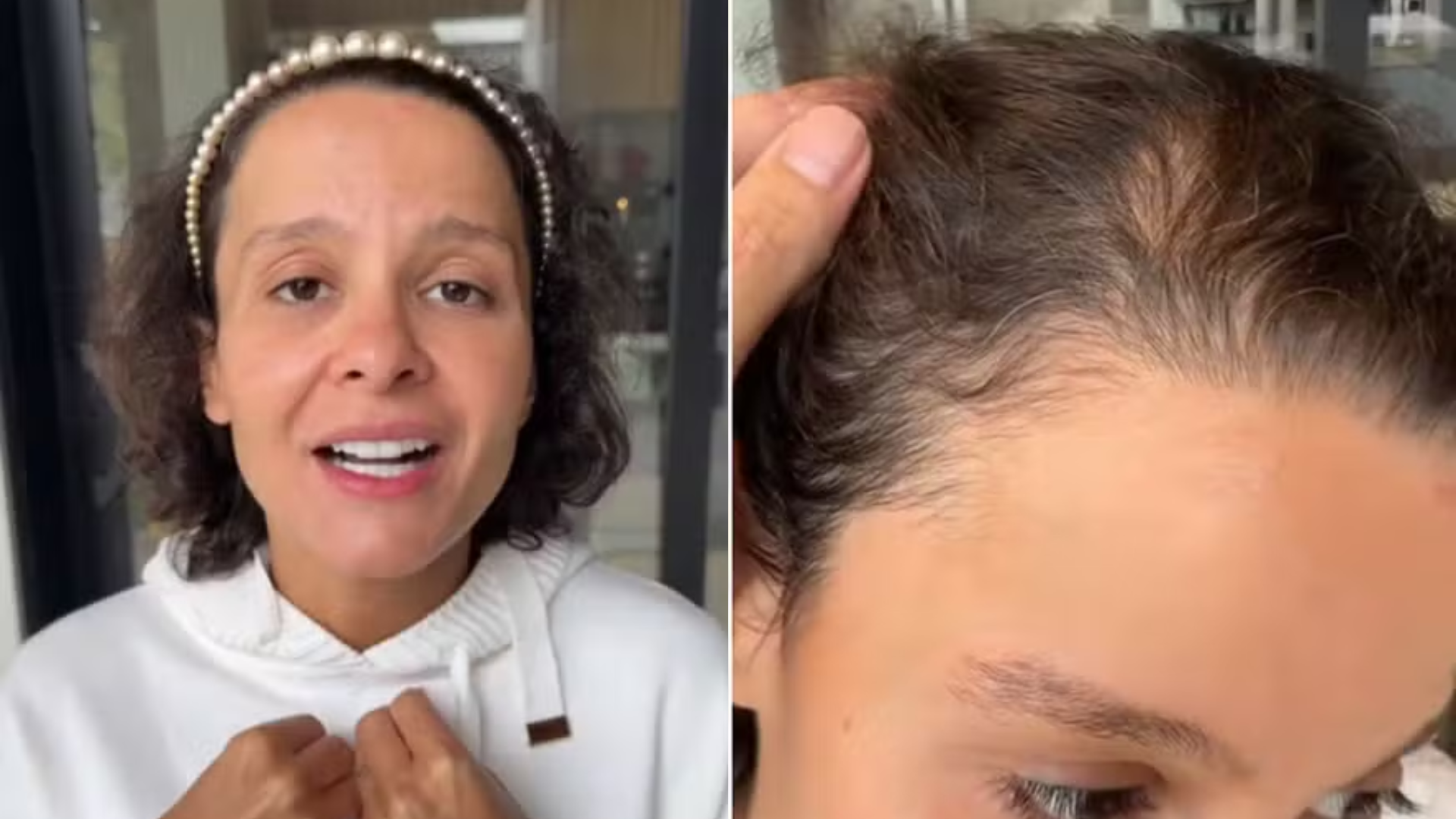 Maiara falou sobre autoestima e queda de cabelo em v&iacute;deo nas redes sociais | Foto: 