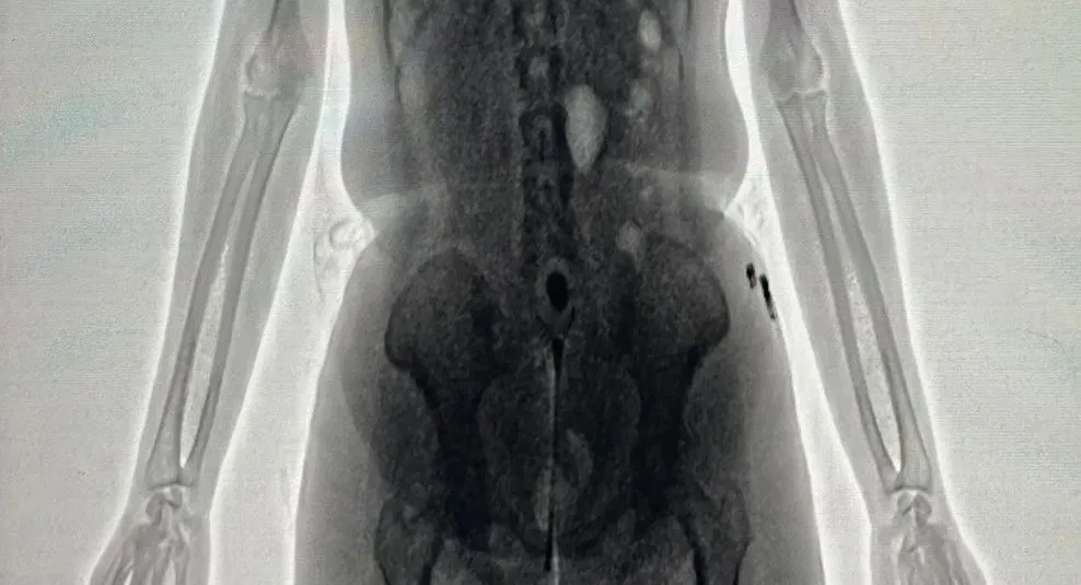 Mulher é detida com drogas nas partes íntimas no Conjunto Penal de Barreiras