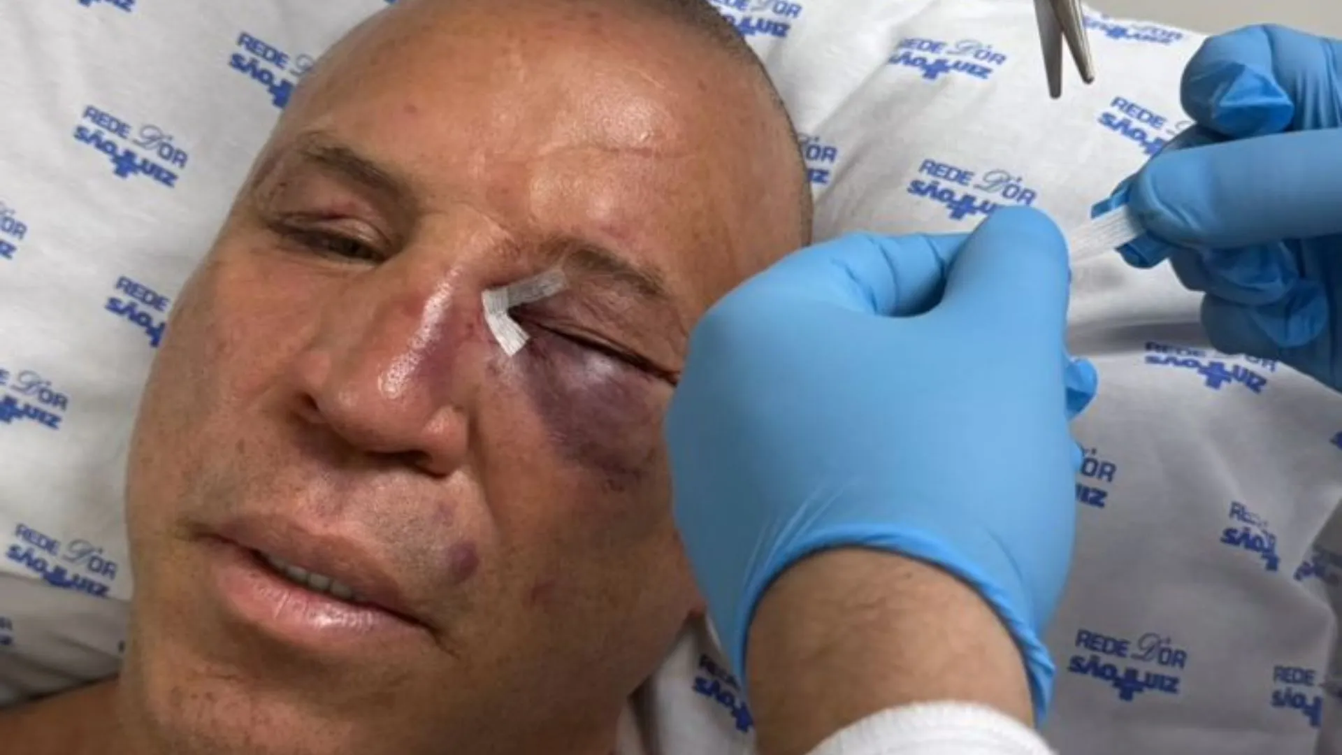 Wanderlei Silva foi levado para hospital após luta