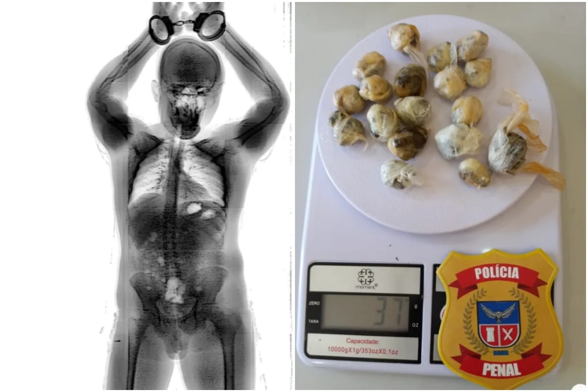 Pego no Raio-X: Homem é flagrado com drogas no intestino em presídio