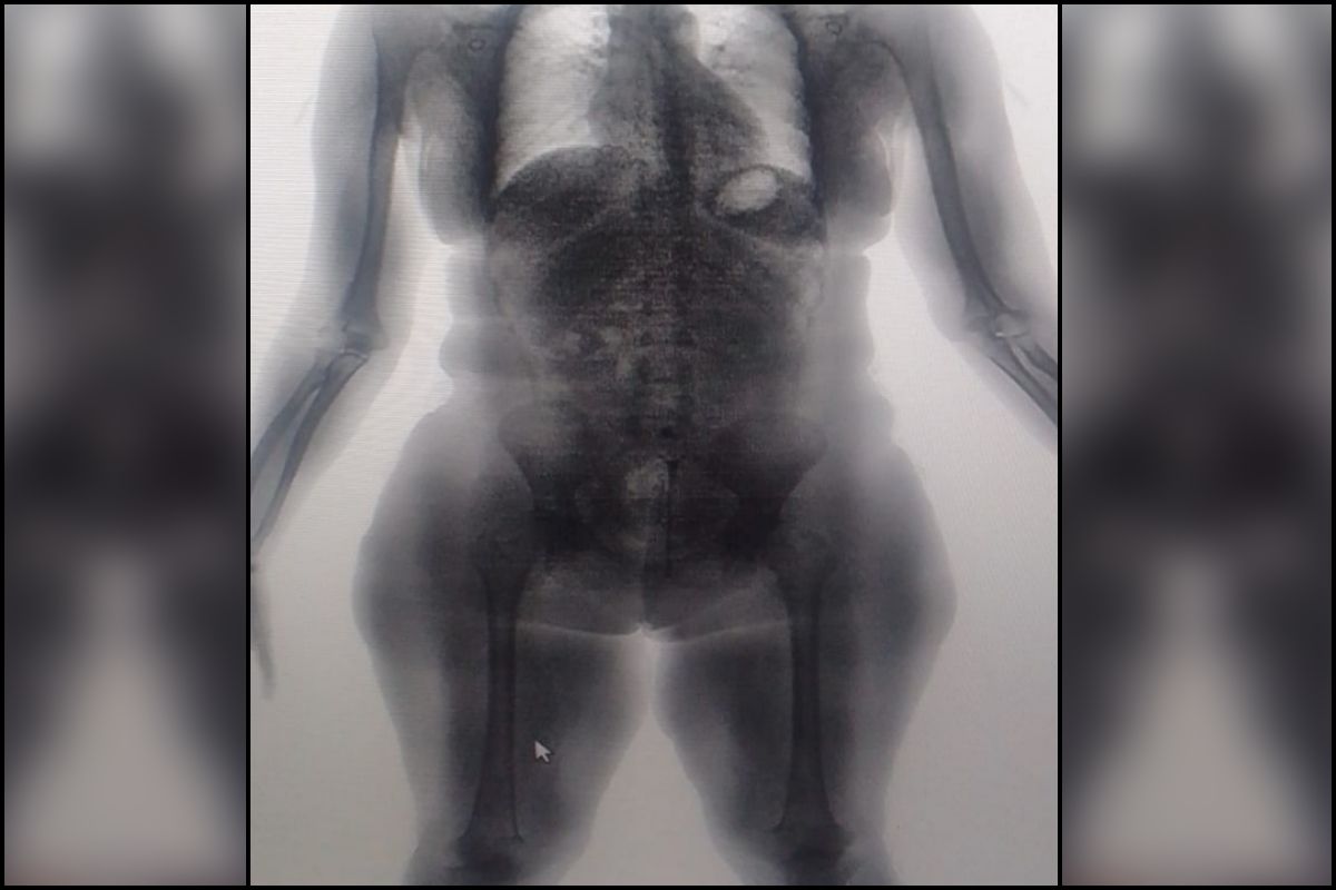 Mulher é flagrada com maconha nas partes íntimas em presídio de Lauro de Freitas. Foto: Ascom/Seap