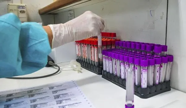 Estudo sul-coreano revela que nove em cada dez pacientes curados da Covid-19 sofrem com os efeitos colaterais