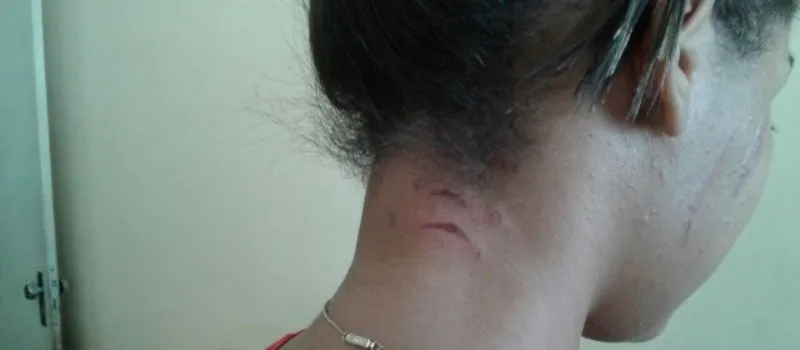 BAIXO NÍVEL: Jovem é agredida e tem cabelo cortado após ser acusada de ‘roubar’ namorado