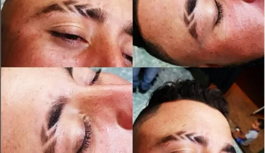Adolescente de 16 anos é baleado após atirador questionar "sobrancelha raspada"