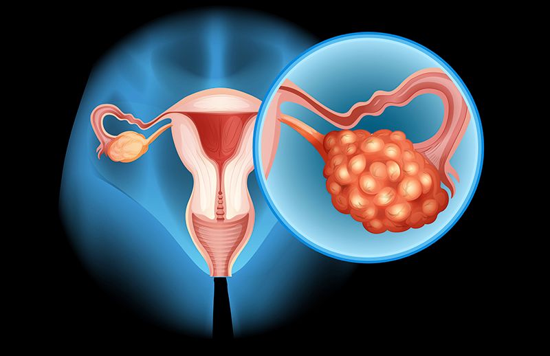 Foto: Ilustração | Instituto Femina