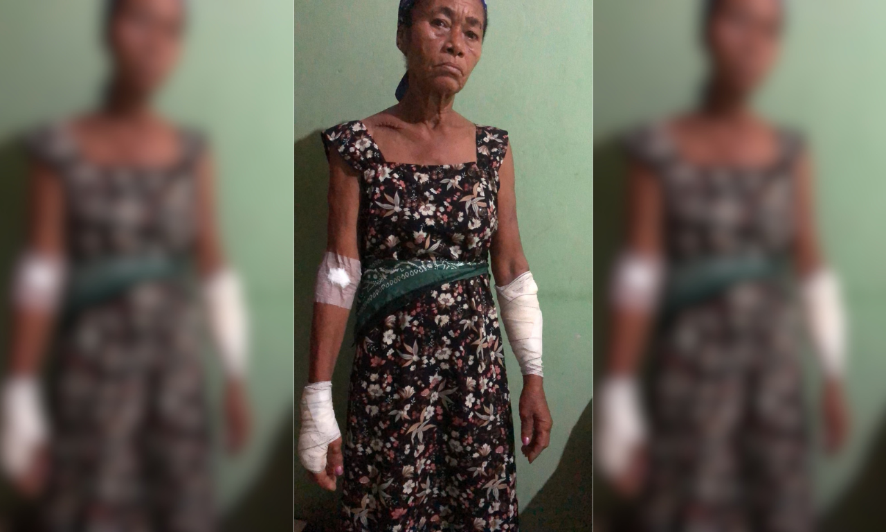 Idosa de 65 anos é esfaqueada pelo companheiro na Bahia; suspeito fugiu.Foto: Arquivo pessoal