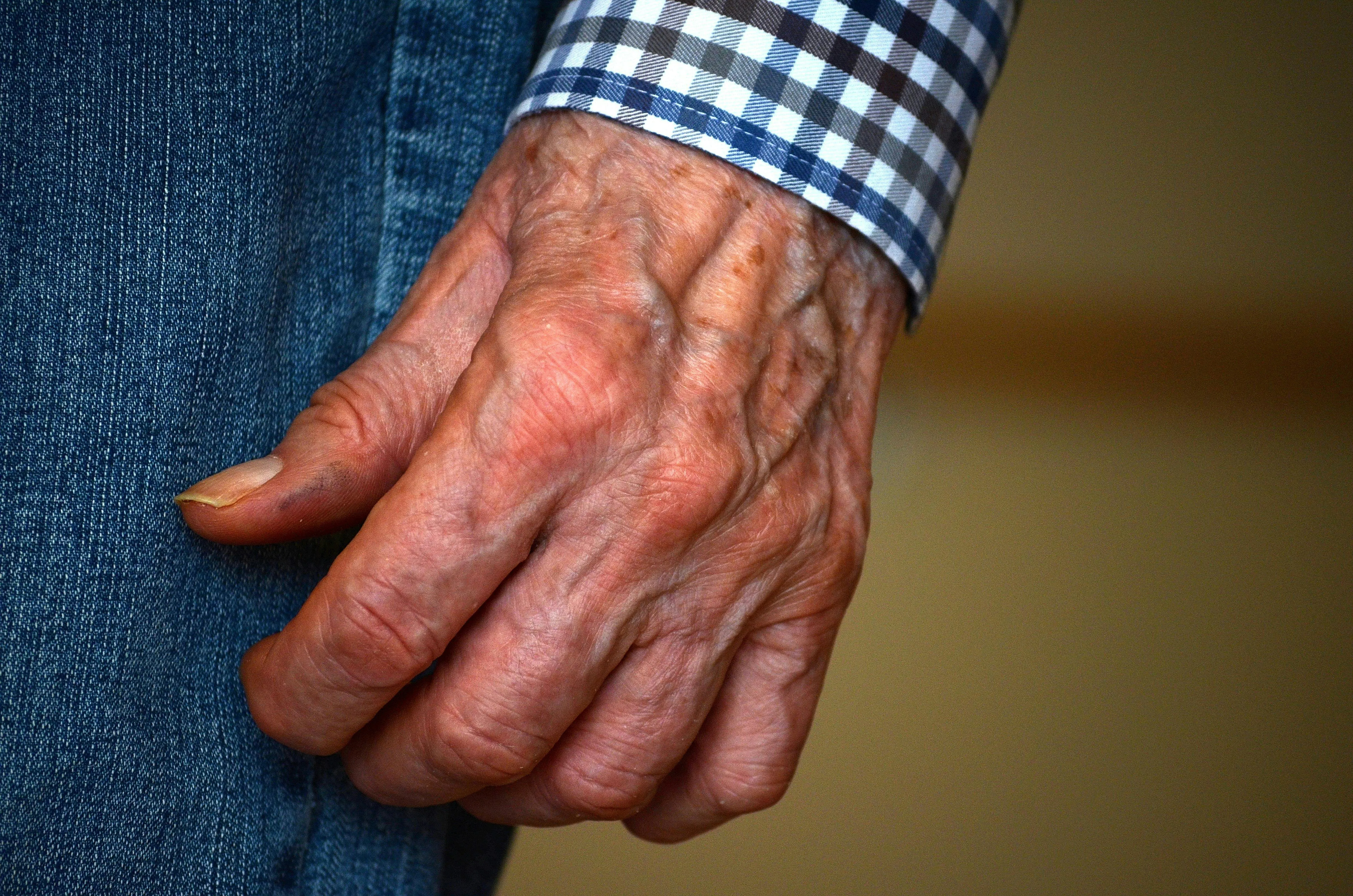 Andar 3 mil passos por dia ajuda a retardar Alzheimer, indica estudo