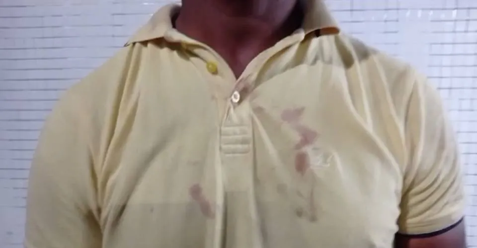 Motorista por aplicativo é agredido com soco na boca por passageira em Salvador