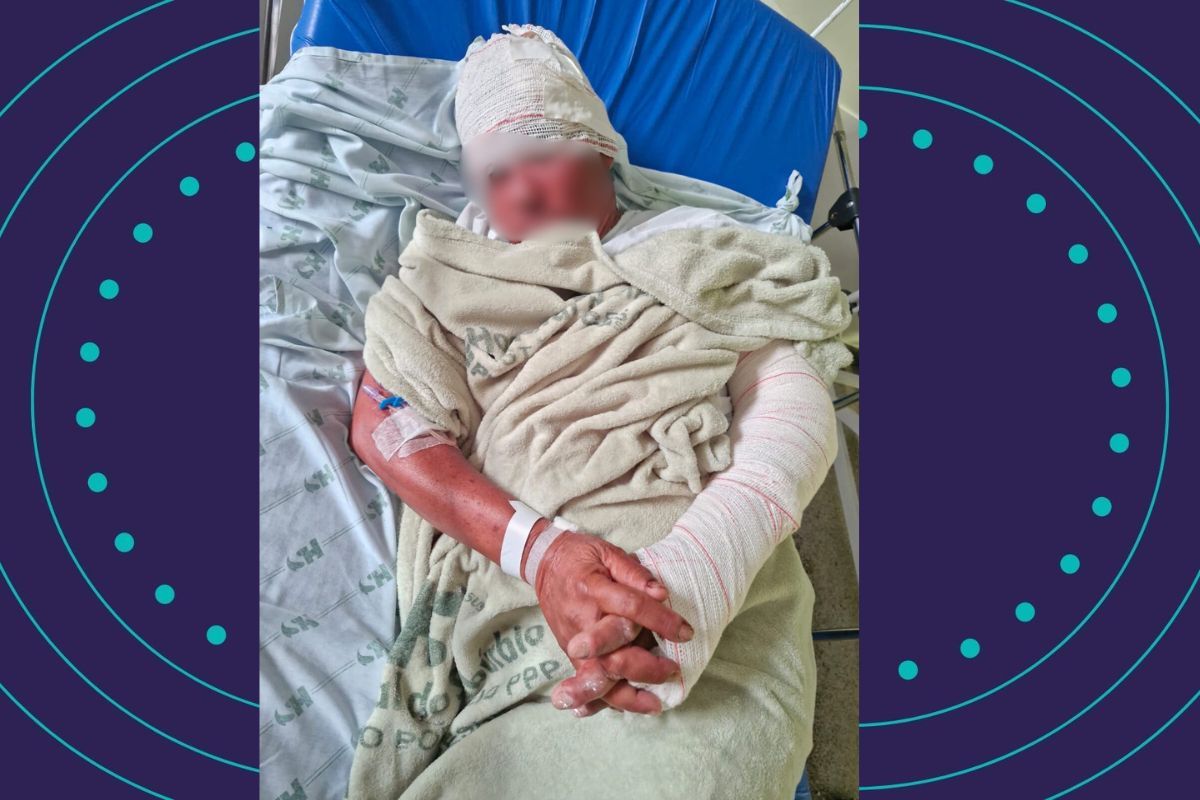 Homem Em Situa&ccedil;&atilde;o De Rua &Eacute; Espancando Em Salvador. |Foto: Reprodu&ccedil;&atilde;o redes Sociais 