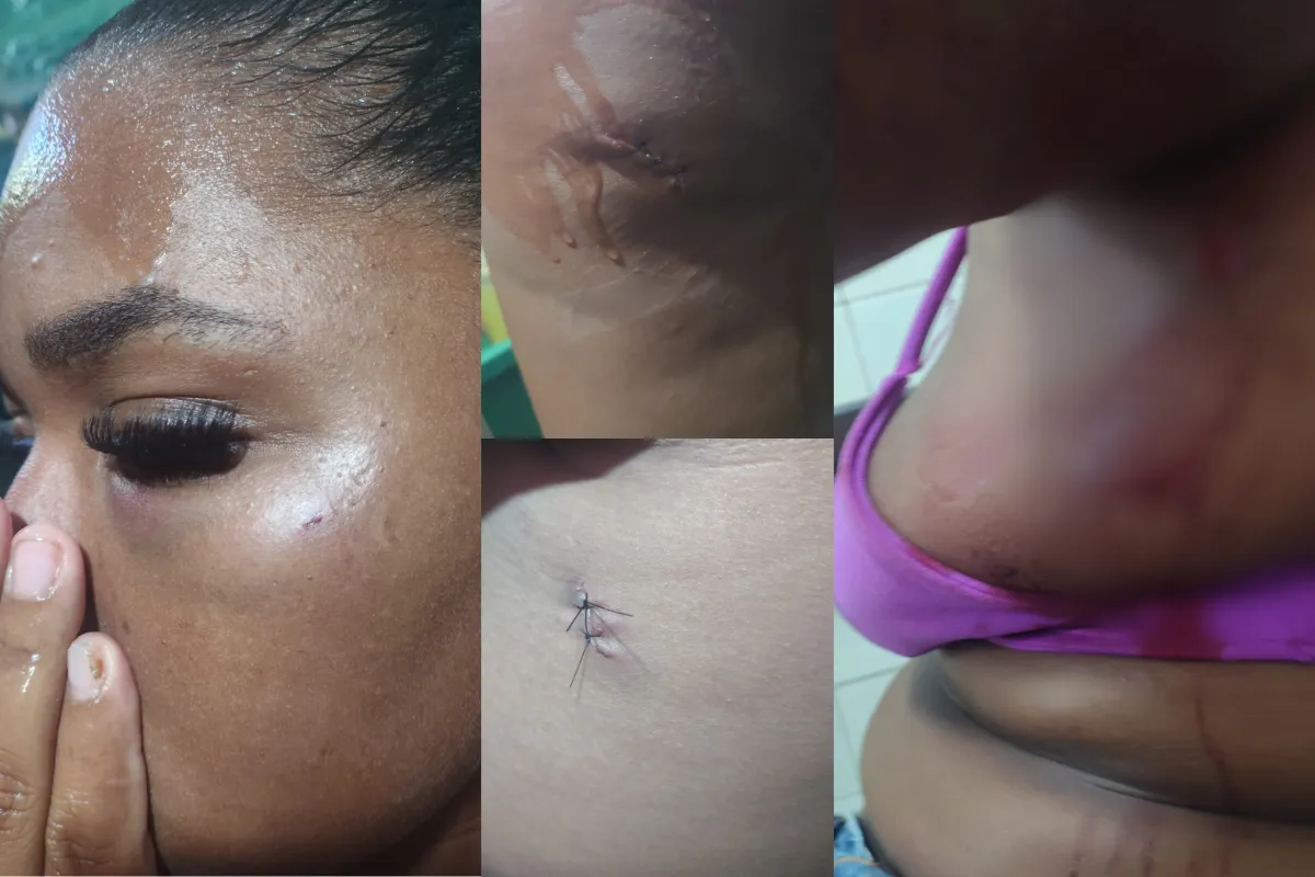 Após agredir companheira, homem se entrega em delegacia em Salvador