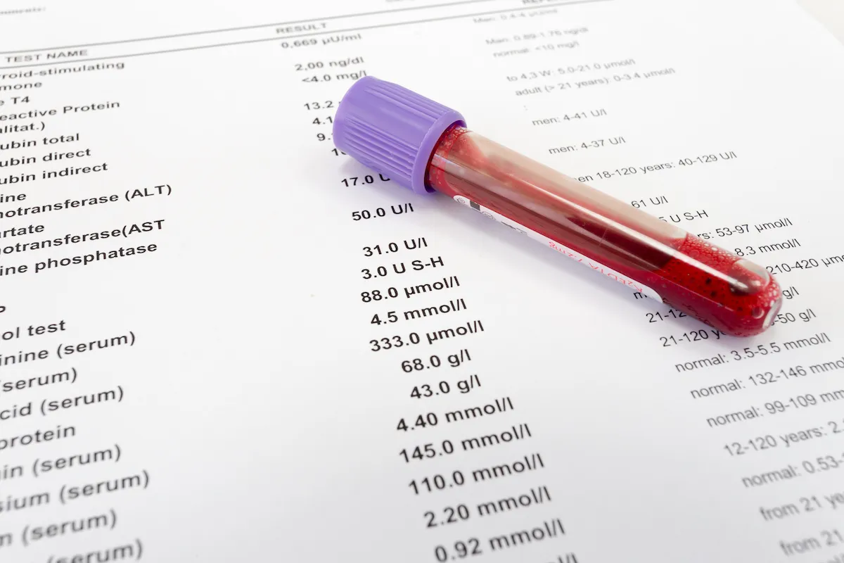 Ministério da Saúde produzirá medicamentos de plasma no Brasil; entenda