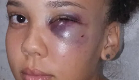 Cantor de trap é acusado de agredir namorada de 19 anos após descobrir sexo enquanto estavam separados; "apertou meu pescoço"  