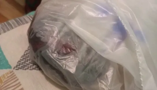 Um mês depois, motorista de app que recebeu rim em saco plástico aguarda autópsia e cirurgia de remoção da bala