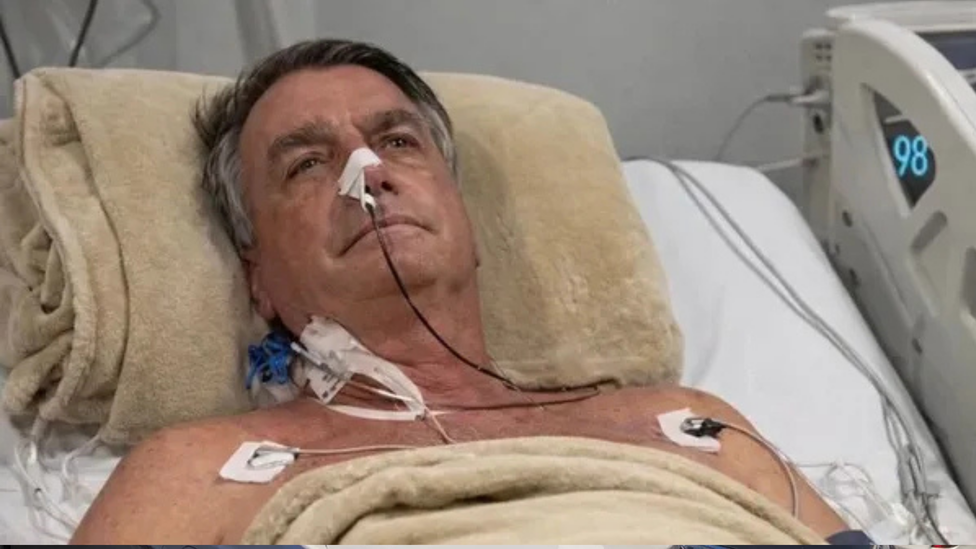 Bolsonaro sofreu queda e bateu a cabeça em cela