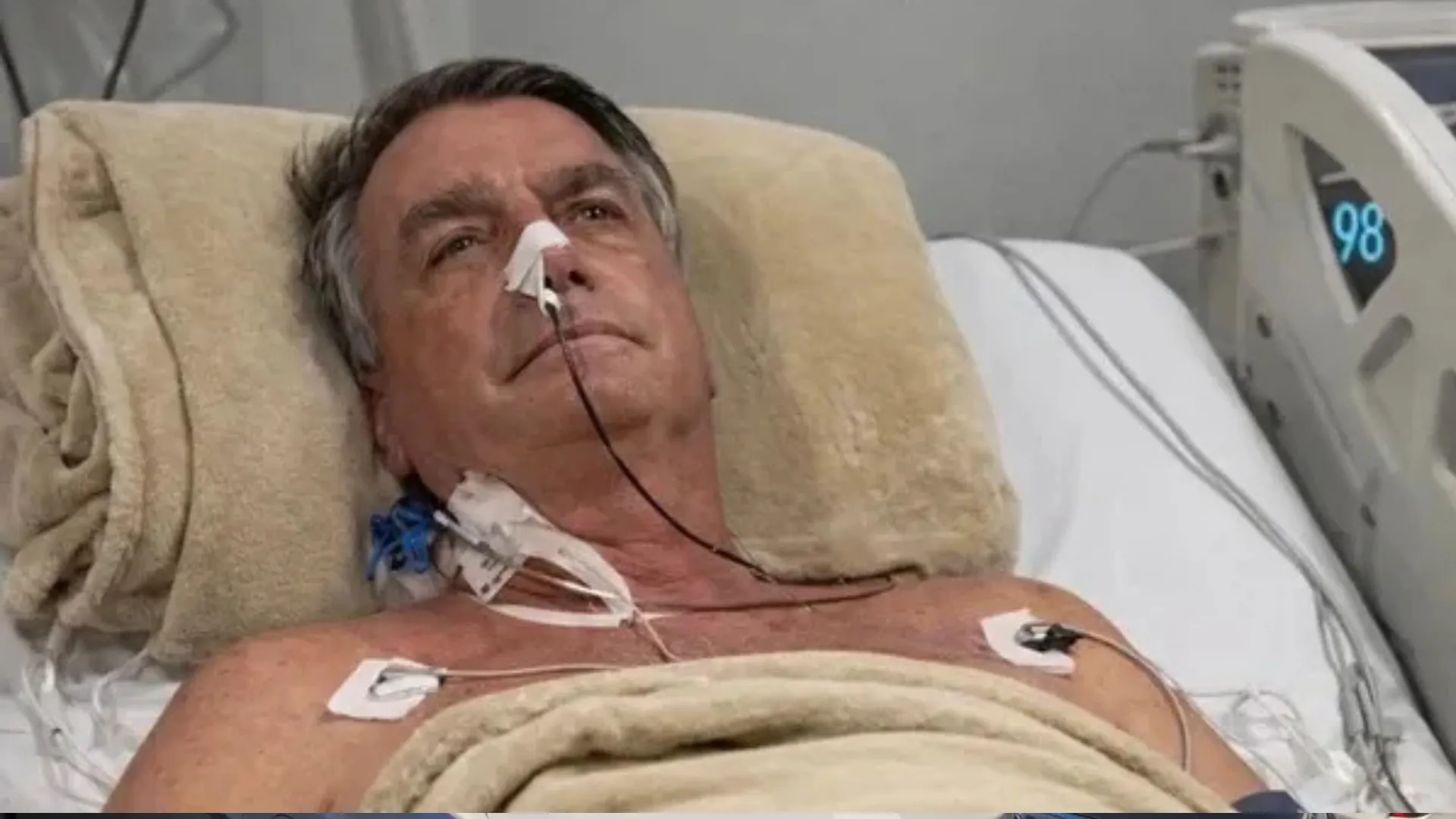 Bolsonaro sofre queda em cela e passa por novos exames