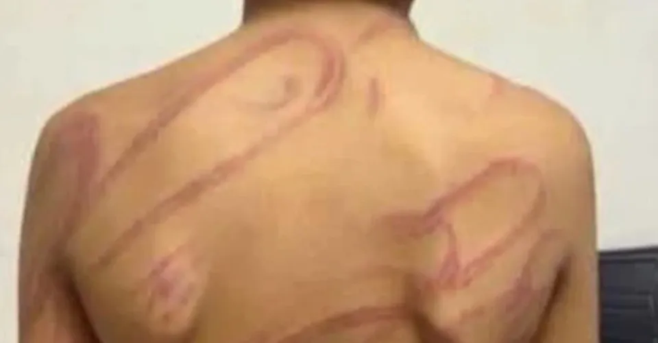 Mulher é presa após agredir filho de 12 anos com chicote