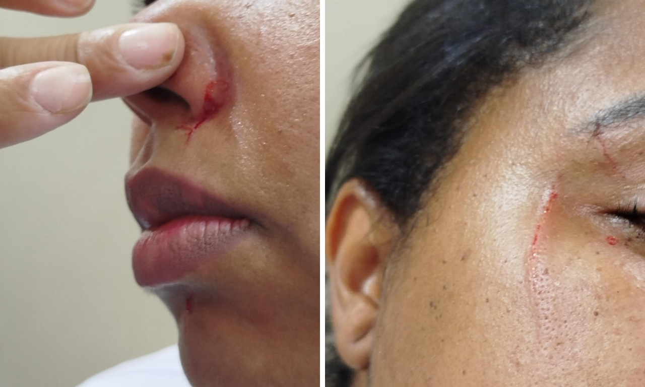 Tr&ecirc;s enfermeiras s&atilde;o agredidas por acompanhante em hospital de Salvador.Foto: Arquivo Pessoal