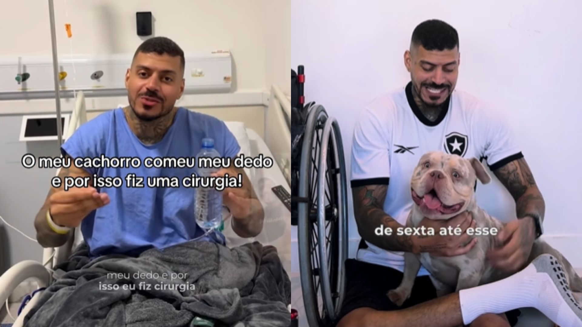 Influenciador explicou situação envolvendo a perda do dedo do pé nas redes sociais