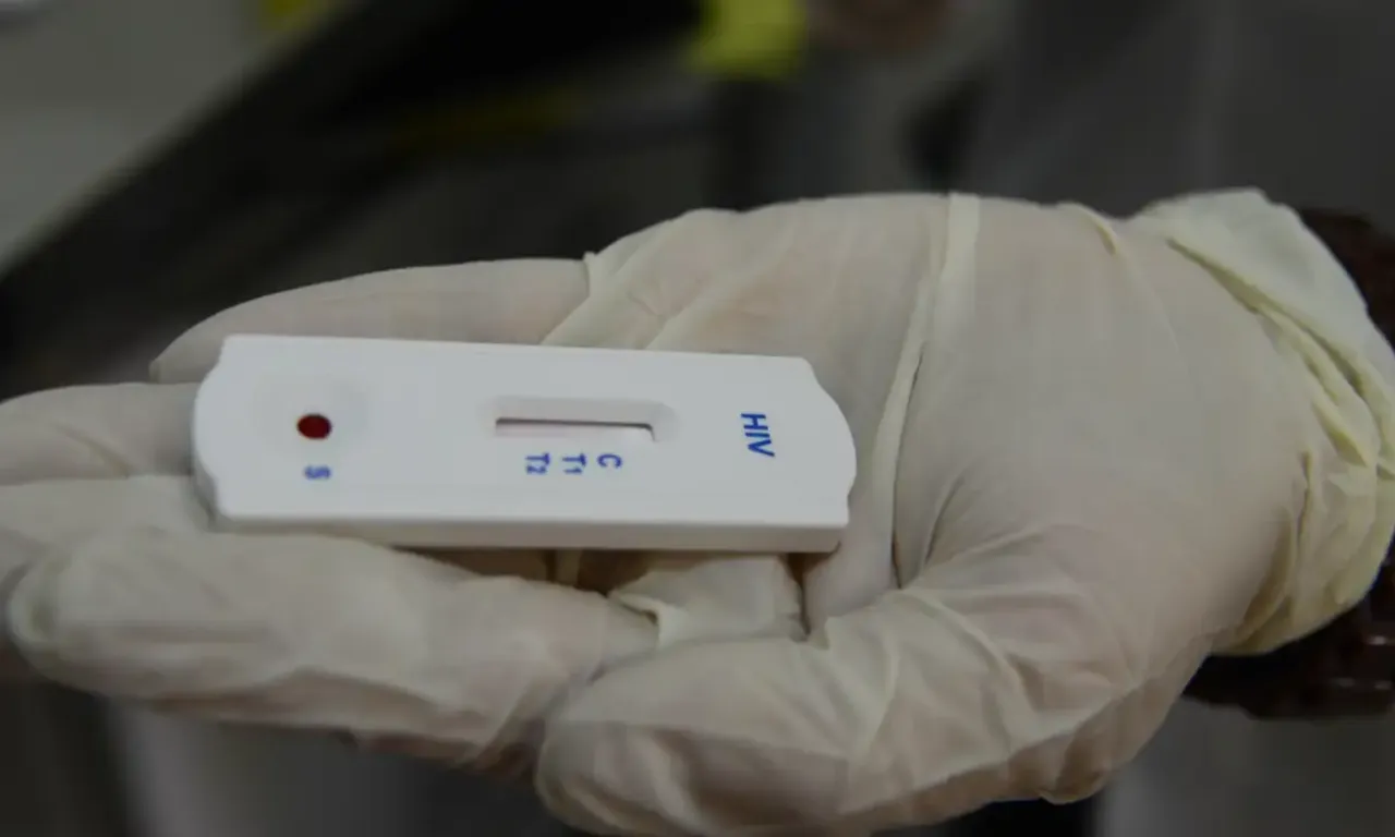 Teste de HIV