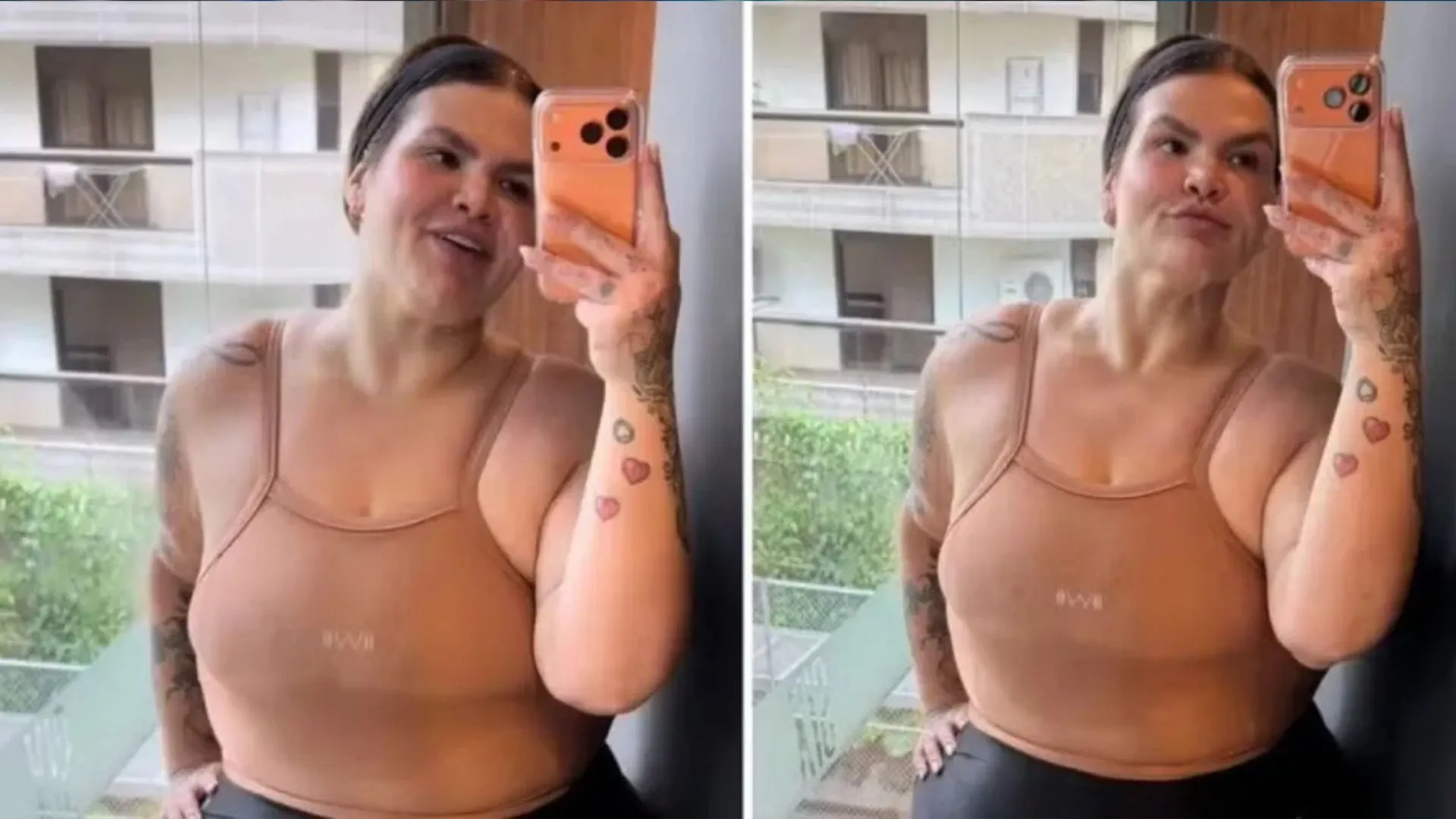 Thais Carla exibe trapézio depois de perder 72 kg com cirurgia bariátrica