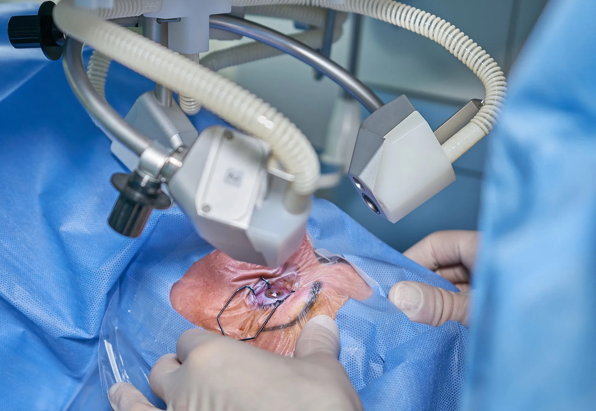 Nove pessoas são orientadas a retirar globo ocular após cirurgias em Salvador