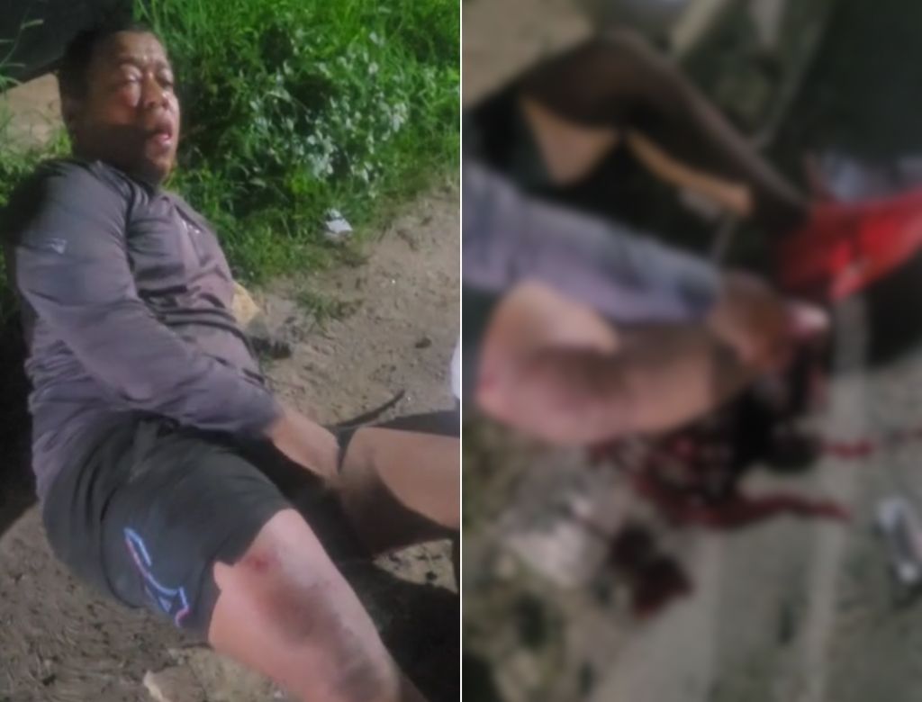 O cantor 7Kssio se envolveu em um acidente com outro motociclista em Lauro de Freitas e está hospitalizado. Foto: Redes Sociais