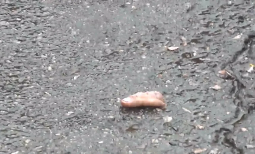 Dedo é encontrado em frente ao HGE e Sesab se pronuncia; veja reportagem
