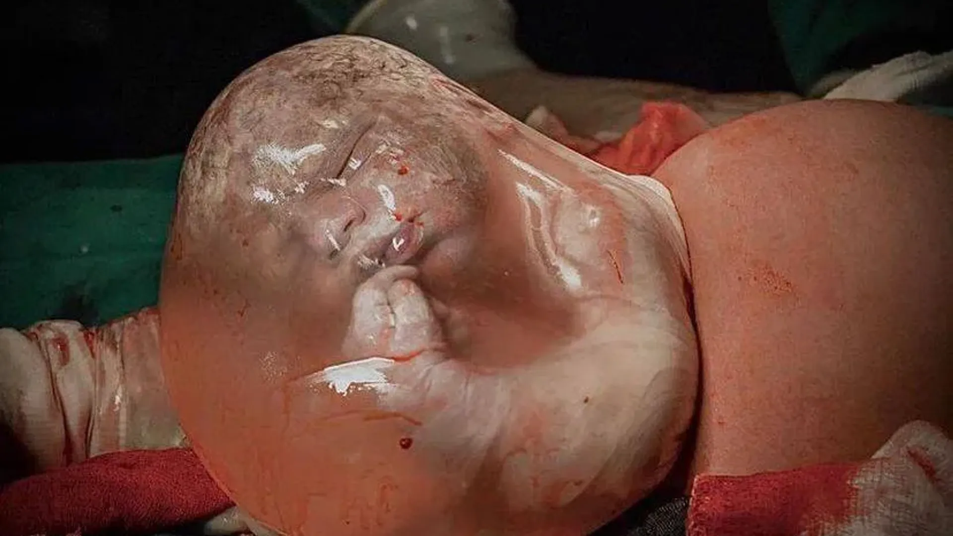 Fotógrafa brasileira Paula Beltrão venceu Oscar da fotografia em 2023 com foto de bebê que nasceu empelicado