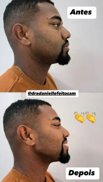 Foto: Redes Sociais