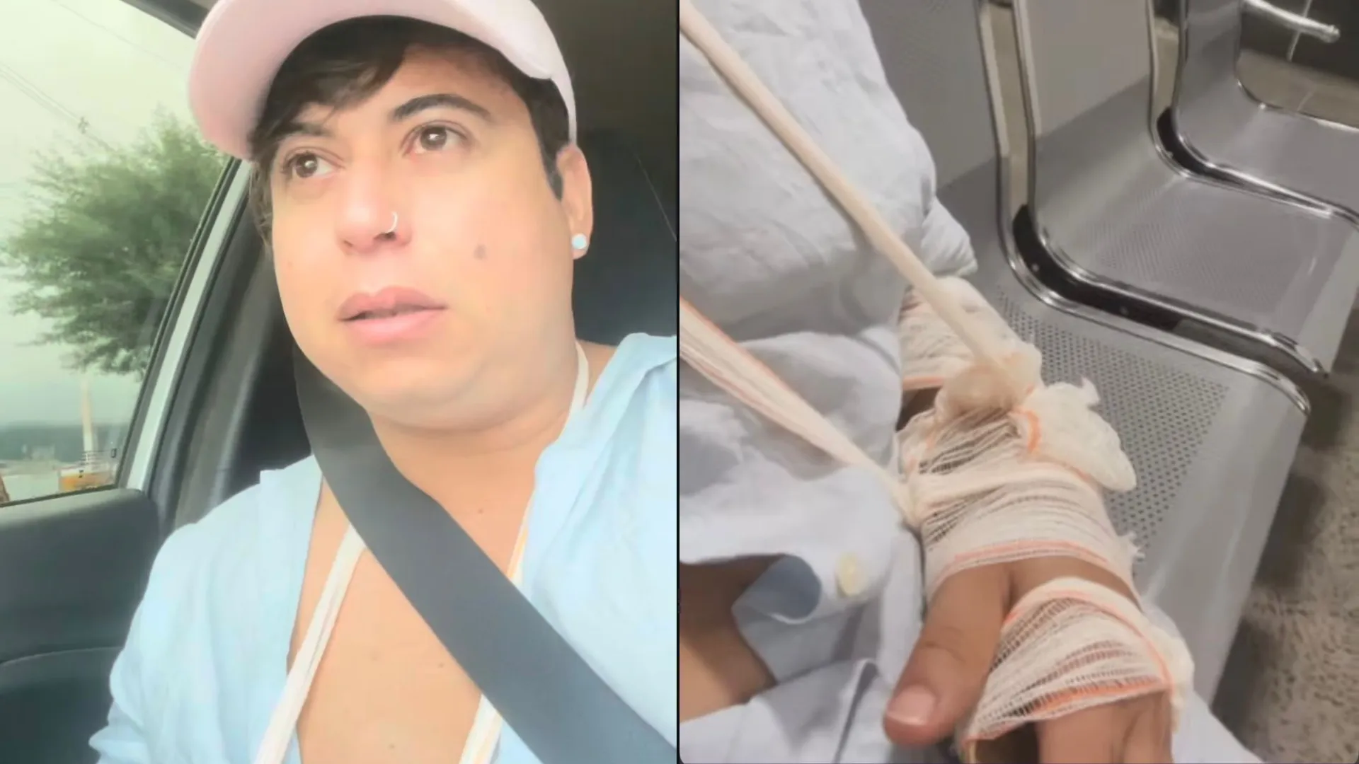 Cantor acusa segurança de agressão em show com Tayrone: 'Quebrou meu braço'