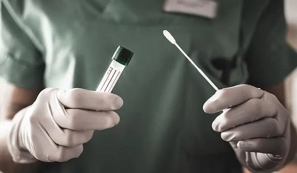 Anvisa aprova ampliação do prazo de validade de quase 7 milhões de testes de Covid-19