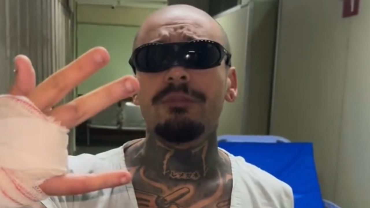 Streamer Perde Dedo Ao Tentar Pular Grade Do Rock in Rio