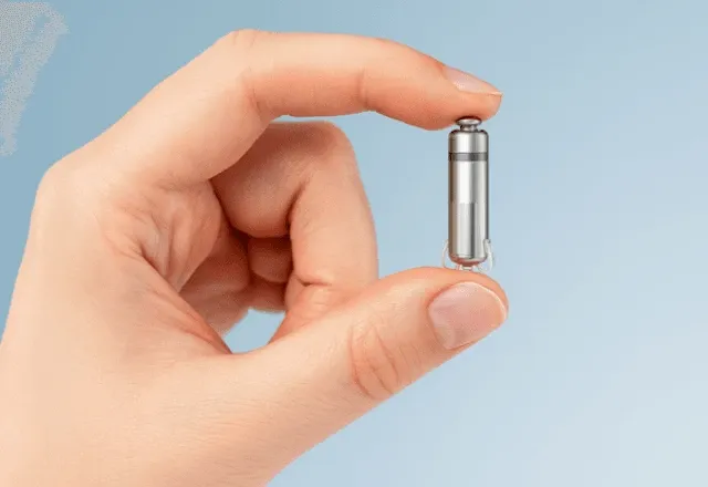 Marcapasso sem fio: Chip no coração reduz cortes e acelera recuperação