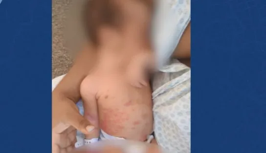Tampa de marmita vira abanador na maternidade Tsylla Balbino: pacientes denunciam falta de ventilação em enfermarias 