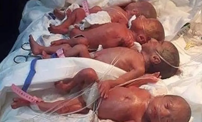 Em caso raro, mulher de 25 anos dá à luz sete crianças no mesmo parto