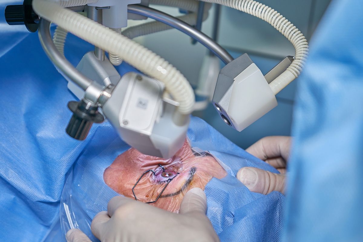 Remo&ccedil;&atilde;o do globo ocular foi recomendada para nove pessoas. Foto: Ilustra&ccedil;&atilde;o