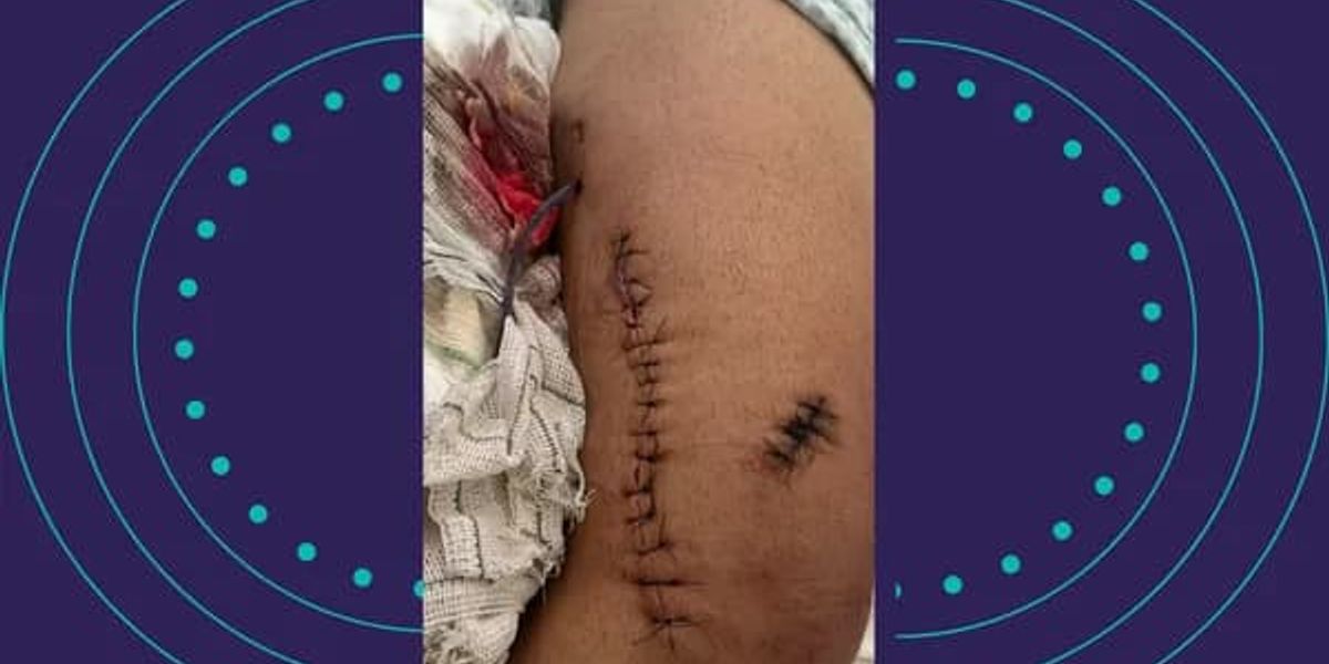 Motorista Baleado Durante Discuss&atilde;o De Tr&acirc;nsito Na Avenida Paralela, Em Salvador