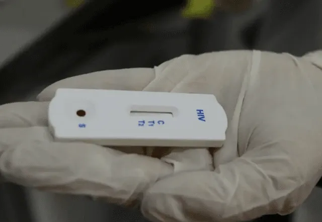 Nova variante do HIV é detectada na Bahia e em mais dois estados brasileiros