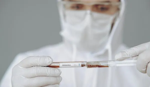 Coronavírus: Brasil contabiliza mais de 6 mil novos casos e 449 mortes em um único dia 