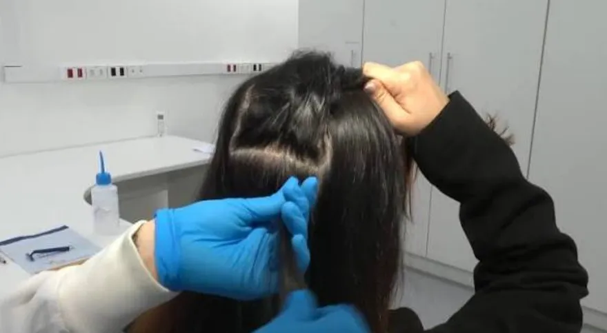 Fio de cabelo e consumo de drogas; entenda o exame toxicológico da primeira CNH na Bahia