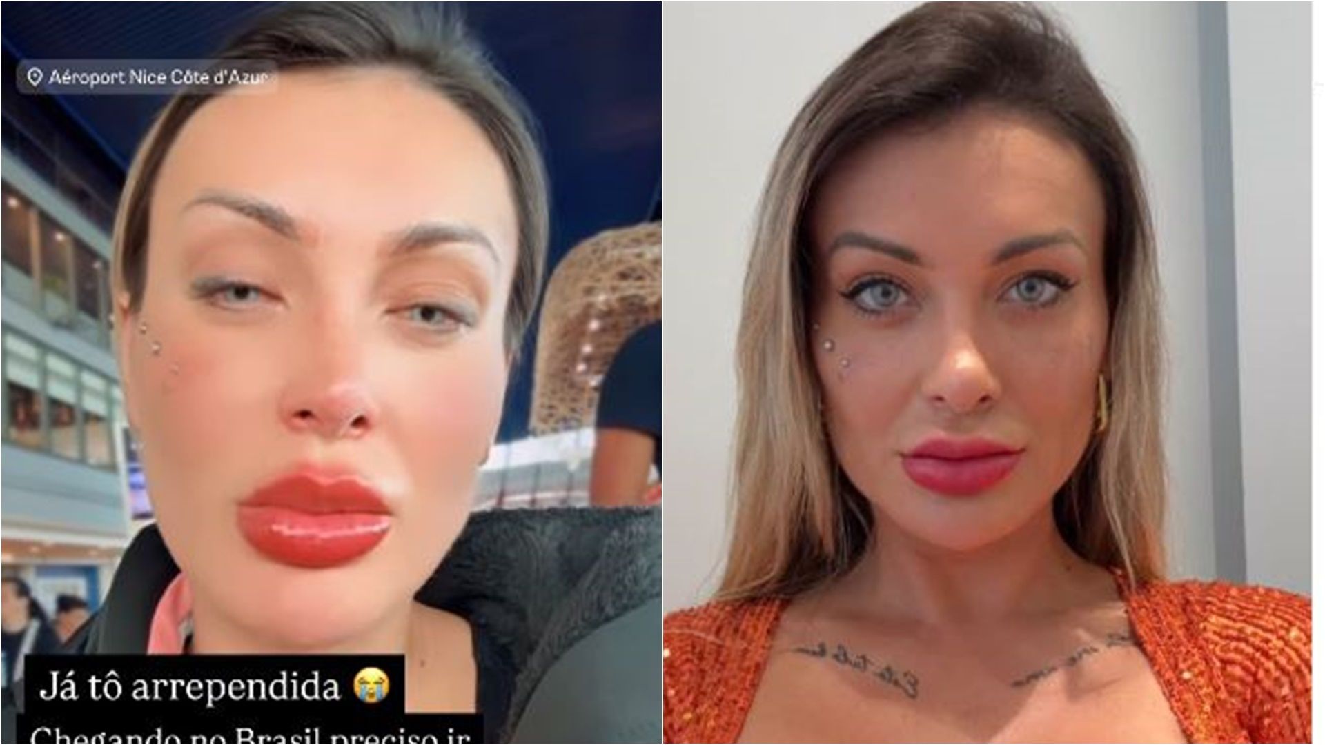 Andressa Urach passa por cirurgia. Foto: Redes sociais 