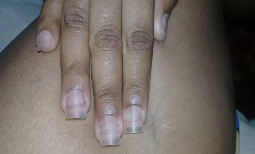 Baiana cria unhas postiças com garrafas pet 86% mais baratas que gel e vidro
