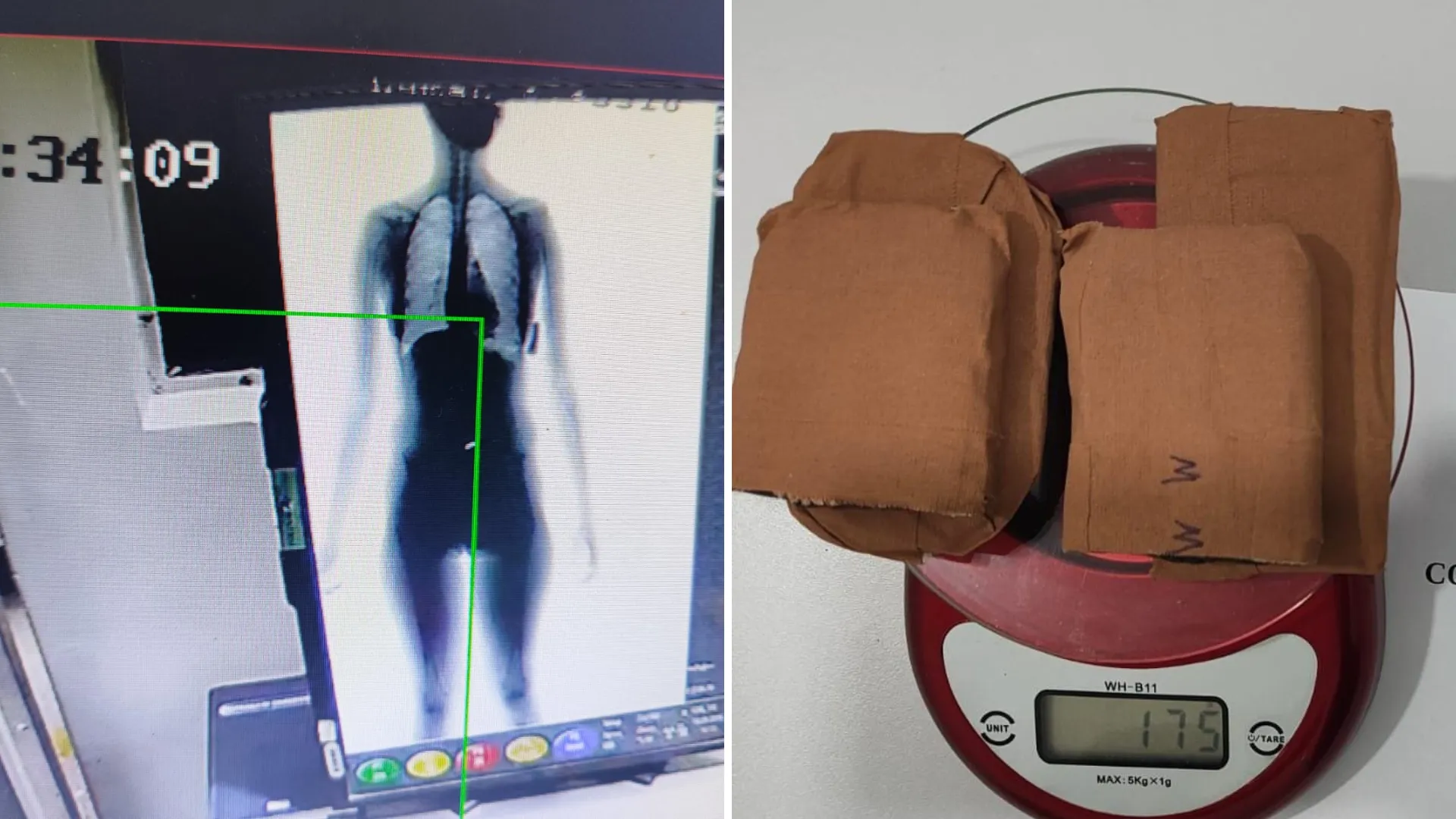 Bodyscan flagra mulher com drogas no Conjunto Penal de Eunápolis