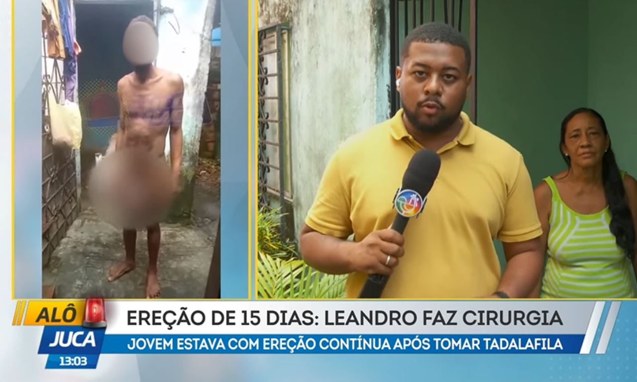 Homem é operado após ereção causada por remédio: 'Perdeu parte do corpo'.Foto: TV Aratu