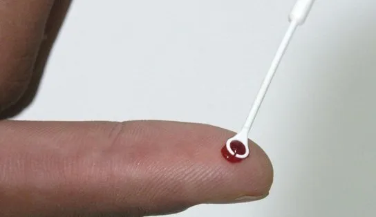 Pesquisadores desenvolvem nova abordagem para combater vírus da aids
